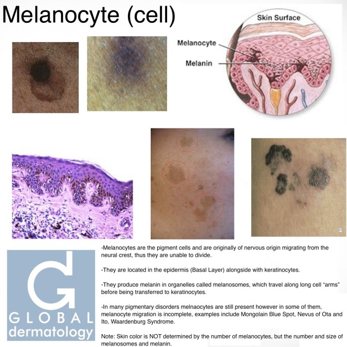 Match the following epidermal cell type with its function melanocytes